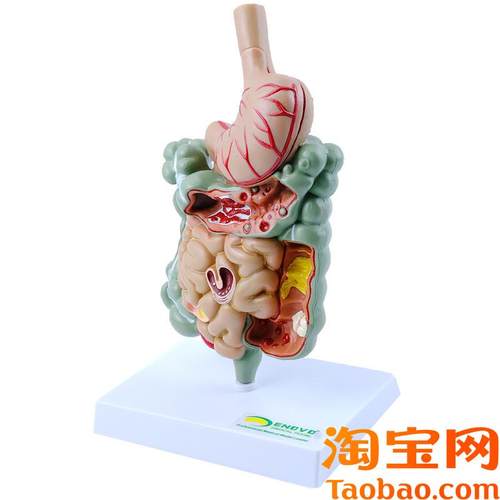 ENOVO颐诺人体胃肠s部疾病演示模型消化内科胃病肠道疾病展示医