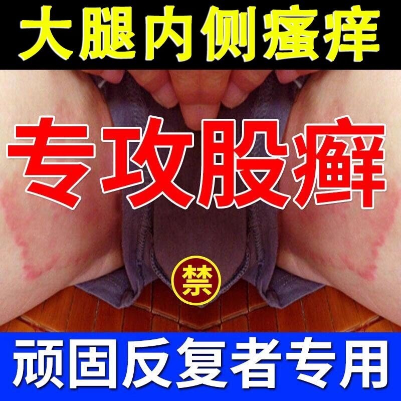 皮肤湿疹止痒薬膏大腿内侧真菌