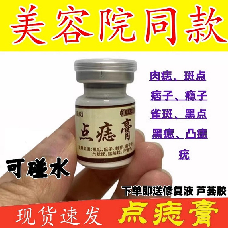 点斑去痣点痣膏脸部专用除志