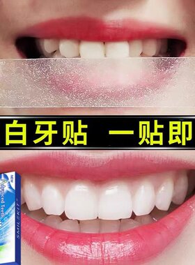 【美国美牙科技】牙贴牙齿去黄洁白变白清洁牙白神器速效美片膜
