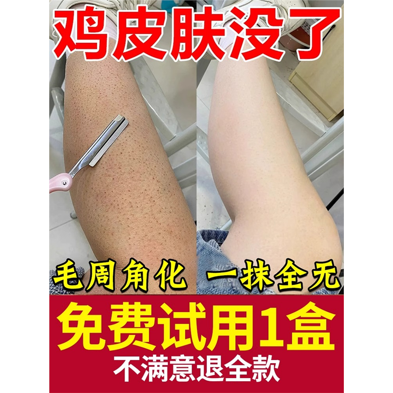 【快速消除】鸡皮肤去除神器毛周角化手臂大腿部去鱼鳞皮毛囊疙瘩