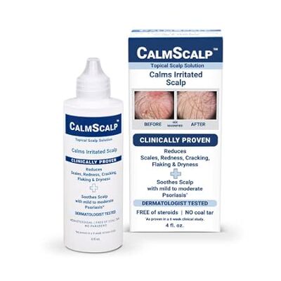 Topical Solution for Symptoms of Mild to Moderate Psorias