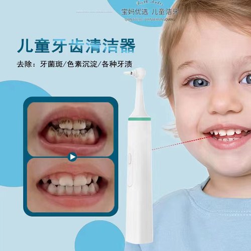 莫兹利儿童牙齿清洁器在家去牙渍