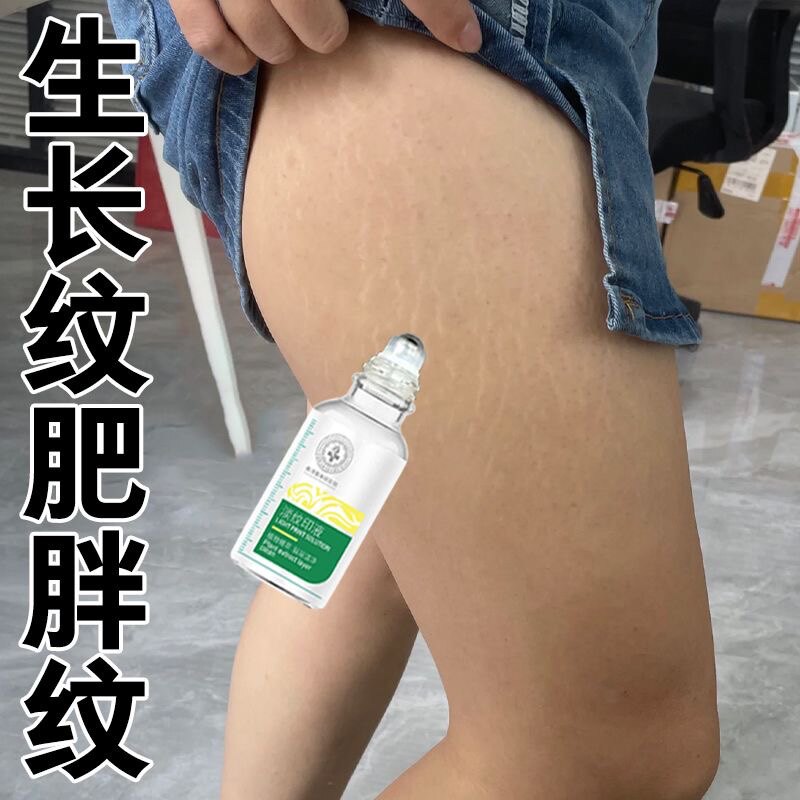 学生专用去除肥胖纹大腿生长纹腹妊娠纹护理