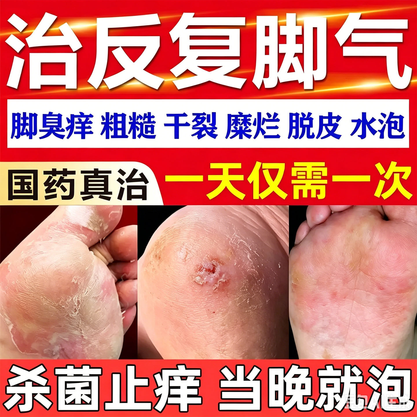 足光散正品官方旗舰店脱皮止痒泡脚药包去真菌脚气臭脚出汗水杨酸