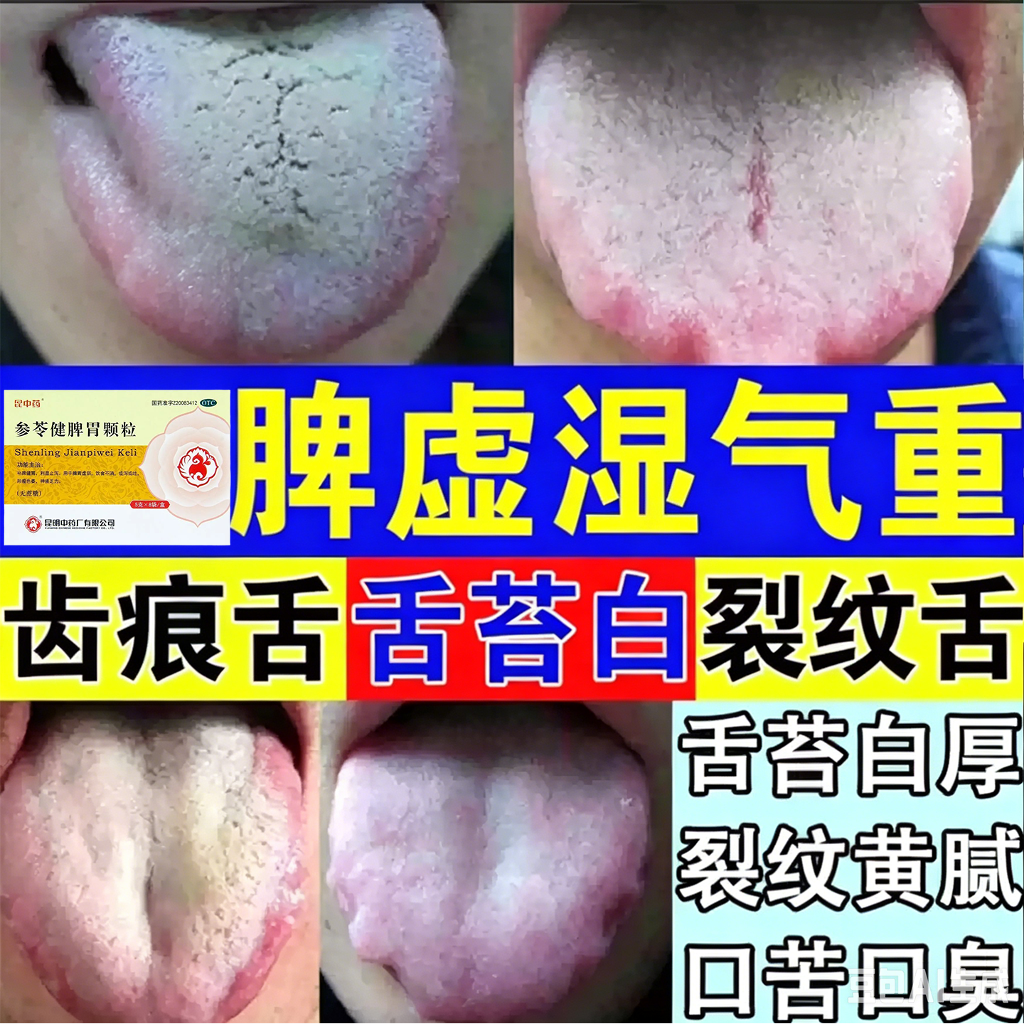昆中药参苓健脾胃颗粒官方旗舰店儿童脾胃虚弱消化不良调理脾胃