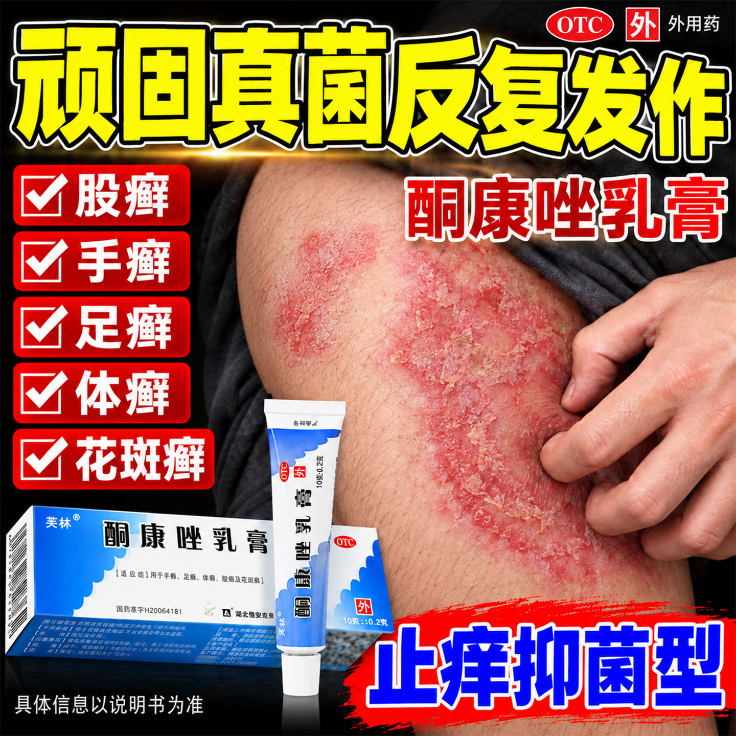 酮康唑乳膏10g脚干裂脱皮股癣手癣脚气大腿内侧真菌感染皮肤瘙痒