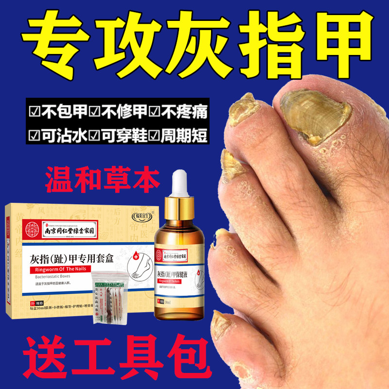 灰指甲特效药有效治疗亮甲正品专用药手指脚趾甲沟炎脱甲膏抑菌