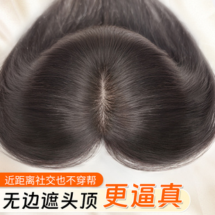 刘海假发女片全真发头顶补发神器蓬松高颅顶自然前额遮白发假发片