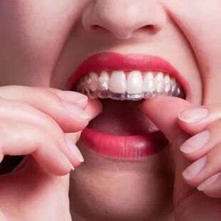 EVA bucal bruxismo dientes para Protector