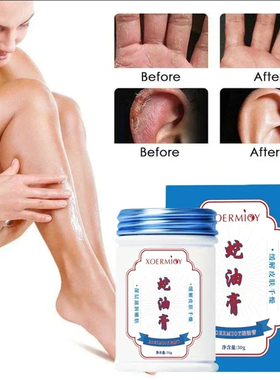 Crema de manos con aceite de serpiente, hidrata, previene gr