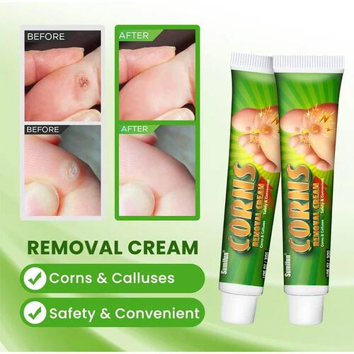 Foot Corn Remover Cream Chicken Eye Skin Infection atment Oi