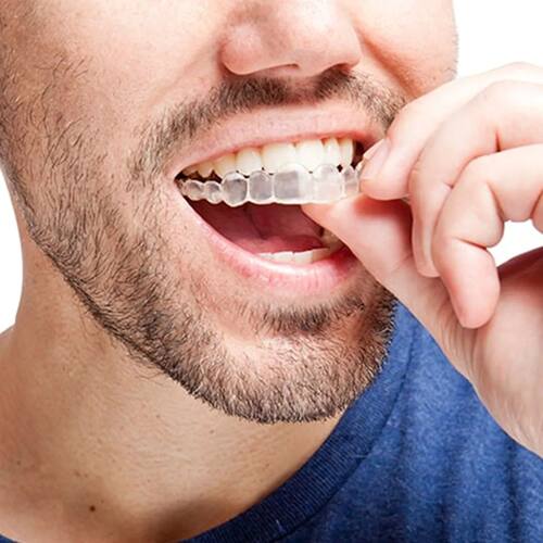 Invisalign-bandejas de termoformado para higiene Dental, ins