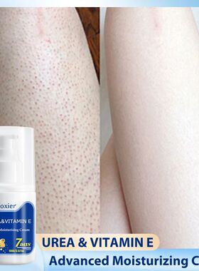 100g Vitamin E Chicken Skin Repair Cream Curing Body Keratos