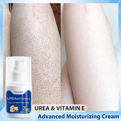 100g Vitamin E Chicken Skin Repair Cream Curing Body Keratos