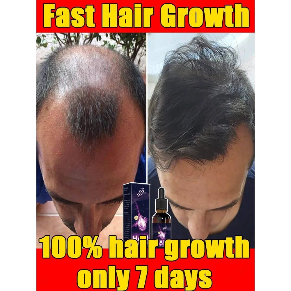 Essência de crescimento capilar de alta qualidade para home