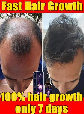 Essência de crescimento capilar de alta qualidade para home