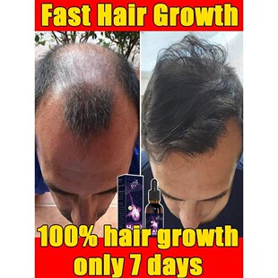 capilar crescimento home qualidade para alta Essência