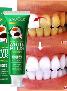 Dentes branquear creme dental rapidamente remover a placa, h