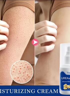 100g Urea Keratosis Pilaris Repair Cream Removal Chicken Ski