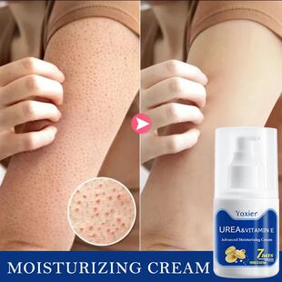 Pilaris Ski 100g Keratosis Removal Chicken Cream Urea Repair