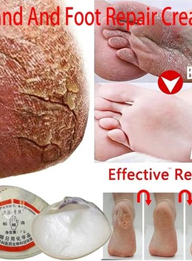 Aceite de almeja clásico tradicional, crema reparadora agri