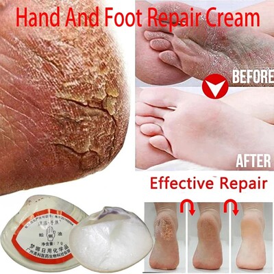 Aceite de almeja clásico tradicional, crema reparadora agri