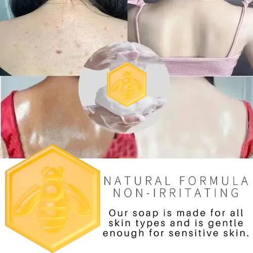 Body Whitening Soap Deep Clean Skin Chicken Skin Removal Soa