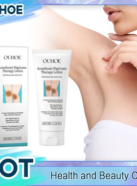 Acanthosis nigricans terapia creme, aliviar a melanina, ilum