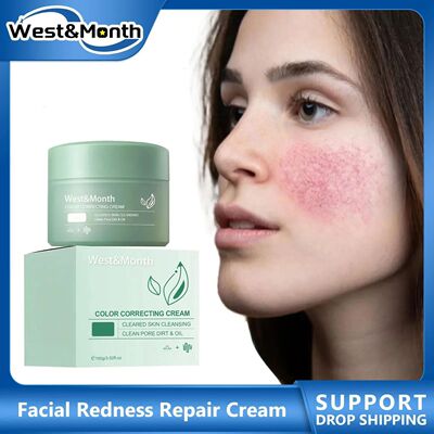 Creme reparador de vermelhid?o, alivia queimaduras solares,