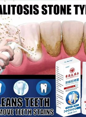 Removedor de cálculo dental, spray de clareamento dos dente