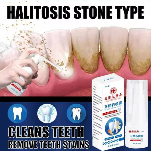 Removedor de cálculo dental, spray de clareamento dos dente