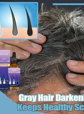 Crescimento do couro cabeludo Cabelo preto Essência de cabe