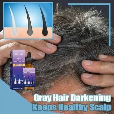 Crescimento do couro cabeludo Cabelo preto Essência de cabe