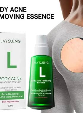 Nádega acne remo??o soro corpo clareamento essência desvan