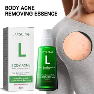 soro remo??o acne desvan clareamento essência corpo Nádega
