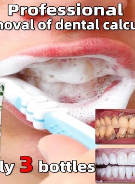 Placa de dente mancha removedor para cálculo dental, remove