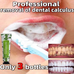 Placa de dente mancha removedor para cálculo dental, remove