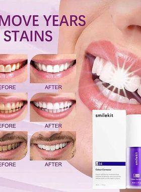 Roxo Clareamento Creme Dental, Remover Manchas, Mousse, Redu