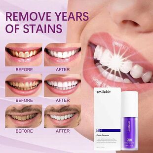 Dental Creme Clareamento Redu Manchas Mousse Remover Roxo