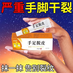 手脚脱皮膏正品严重干裂手痒皮肤手掌干燥水泡抑菌粗糙防裂超滋润