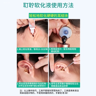 不锈钢耳科枪状镊子组培弯镊掏耳采耳耵聍夹鼻喉鱼刺镊子摆盘