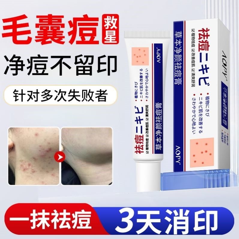 草本淡化痘印痘痘痘坑痘疤膏净颜膏面部祛粉刺闭口青春痘温和润肤