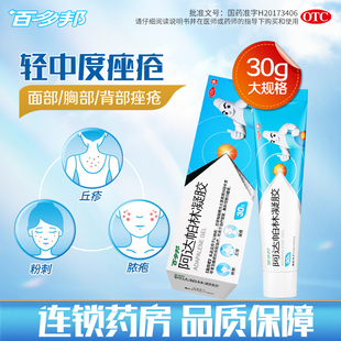 胸部背部面部粉刺丘疹膿皰尋常型痤瘡正品 百多邦阿達帕林凝膠30g