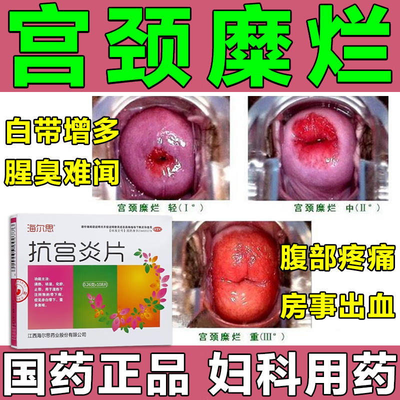 【海尔思】抗宫炎片260mg*108片/盒选佳泰软胶囊桔王分散片康乃馨官方自营正品旗舰店