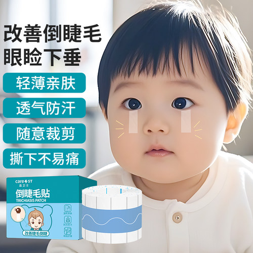 儿童倒睫毛贴非矫正婴儿低敏宝宝下眼睑提拉眼皮成人倒睫毛贴神器