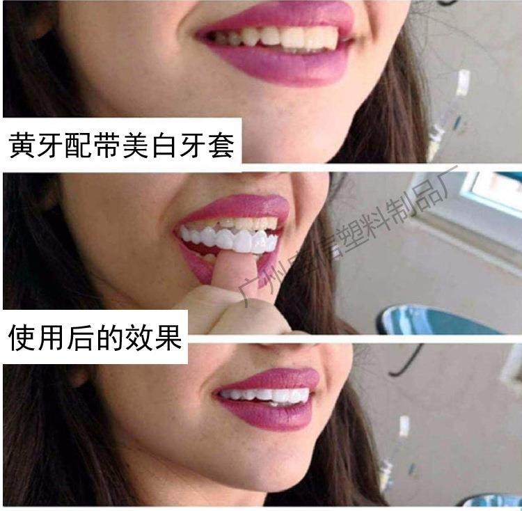 牙套吃饭神器缺老人男女美牙齿贴片防塞牙白临时假牙骁豹牙套牙仿