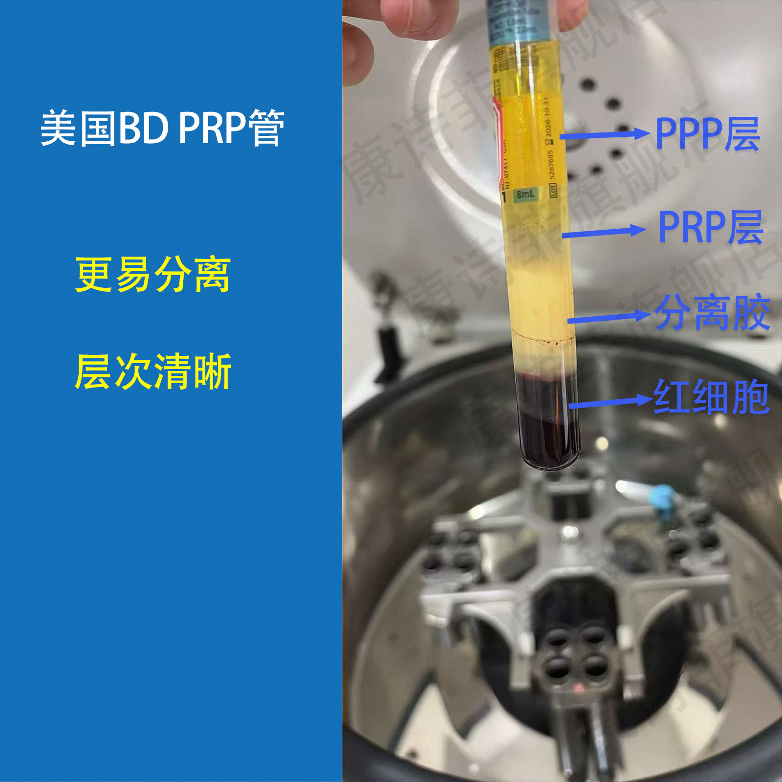 进口美国BD 362761无菌prp采血管8ml正品血清分离提取试管CPT管