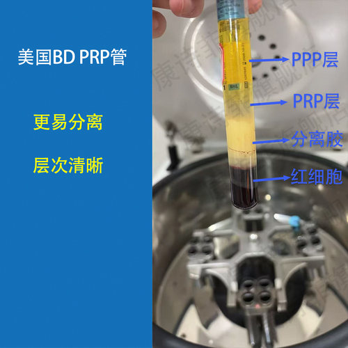 进口美国BD 362761无菌prp采血管8ml正品血清分离提取试管CPT管