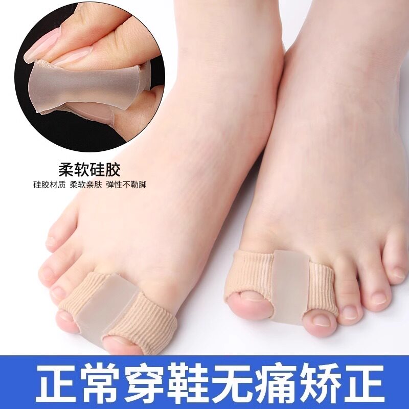 分趾矫正儿童脚趾矫正器双孔拇指外翻重叠趾专用分趾器纠正矫形器